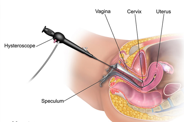 Aadira Kidney Care