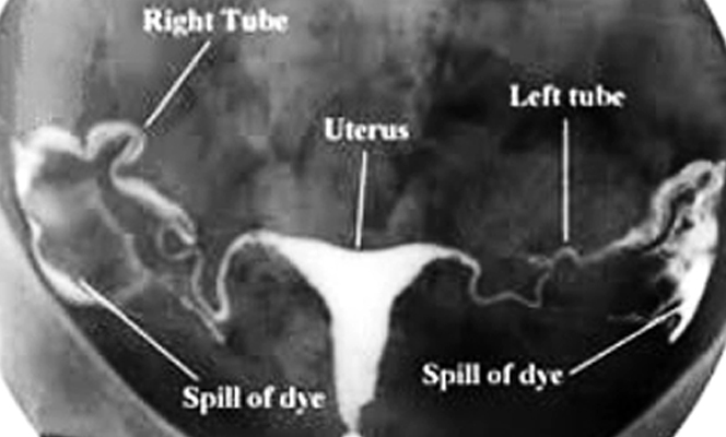 Aadira Kidney Care