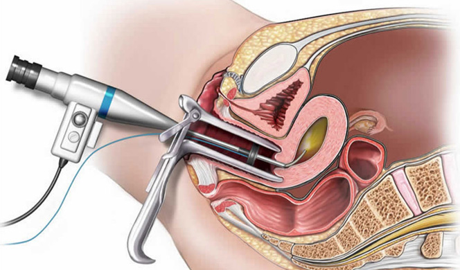 Aadira Kidney Care